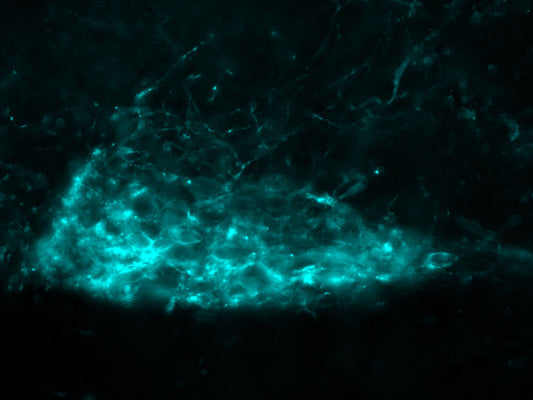 Immunolabeling of mouse hindbrain dorsal motor nucleus of the vagus (DMV) neurons expressing an hM3Dq-HA tag (Anti-HA Epitope Tag, Cat ET-HA100, 1:200). The image is kindly provided by Nicholas Conley, Neuroscience Graduate Program, University of Virginia.
