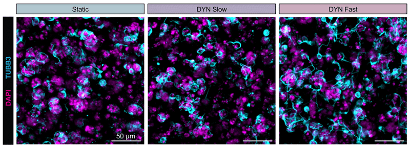 Representative maximum projection fluorescence images of hNPCs encapsulated at 3 × 104 cells/μl within all three gel formulations after 7 days of culture with labeled cell nuclei (DAPI, magenta) and neuritic extensions (TUBB3, cat. TUJ, 1:1000; cyan). Image from publication CC-BY-4.0. PMID:37862423