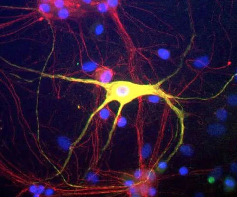 Rat mixed neuron/glial cultures stained with anti-Peripherin (green) and rabbit anti α-internexin (red). Nuclei are stained with DAPI (blue).