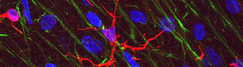Microglia In Focus