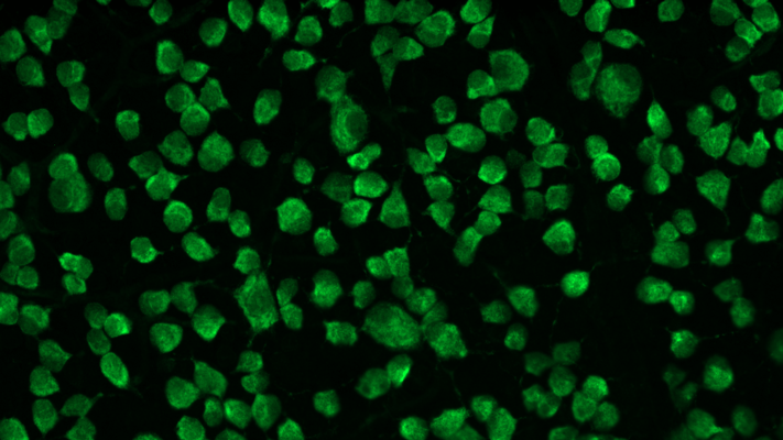 Immunostaining of rat retinal ganglion cells showing specific immunolabeling of RBPMS(1:500) in green. Photo courtesy of Brian Choi, Univ. of Toronto. 