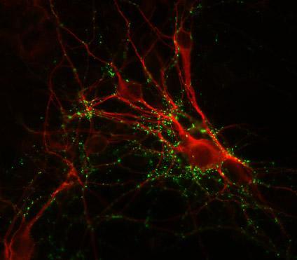 Immunostaining of cultured mouse caudate neurons showing punctate distribution of synapsin (cat.  1926-SYNP, 1:1000, green) and MAP (red). Cells and photo courtesy of QBMCellScience.
