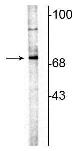 Western blot of rat hippocampal lysate showing specific immunolabeling of the ~70 kDa ChAT. 