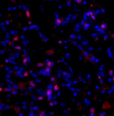 Immunostaining of fibrotic mouse lung tissue showing specific staining of collagen I molecules (cat. 621-COLP, 1:100, red) that are still associated with the cells in which they were synthesized. The blue is staining DNA.
