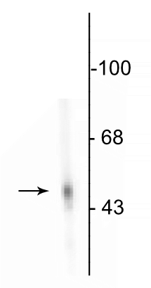 Western blot of rat adrenal medulla showing specific immunolabeling of the ~55 kDa DDC protein.