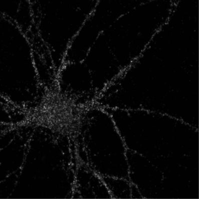 Immunofluorescence staining of 14 DIV cultured rat cortical neuron with N355/1. Image courtesy of Brad Elmer and Kim McAllister (UCD).