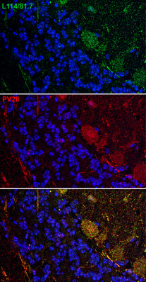 Array tomography immunofluorescence volume reconstruction of 8 serial LRWhite-embedded 70 nm sections from adult mouse cerebellum with L114/81 (green), rabbit Parvalbumin (Swant PV28, red) and DAPI (blue), with composite overlay (bottom). Images courtesy of Kristina Micheva (Stanford).