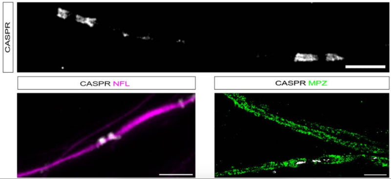 In mature myelinating cultures, SCs CASPR (cat.75-001, 1:500; white) can be detected in the characteristic staining pattern marking paranodes. Scale bar 5 μm. Paranodal CASPR co-localised on NFL-labelled axons (magenta). Scale bar: 5 μm. When colabelling with MPZ (green), CASPR is localised to paranodal loops adjacent to a node of Ranvier. Scale bar: 10 μm. Image from publication CC-BY-4.0. PMID:37642648