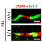 Immunofluorescence showing labeling of CASPR (red) and Kv1.2(green) in the spinal cord of P21 Shank3(+ / +) and Shank3Δ11(−/−) mice. Image from publication CC-BY-4.0. PMID: 35726031