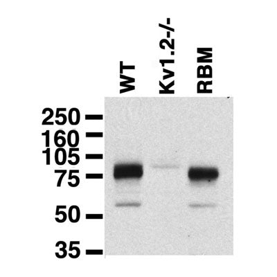 Immunoblot on brain membranes from wild-type (WT) and Kv1.2 knockout (Kv1.2-/-) mice and from adult rat brain (RBM).