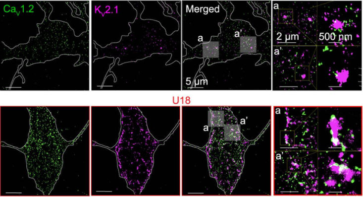 Representative super-resolution TIRF images of CTL (black) and U18-treated (red) neurons co-immunolabeled for CaV1.2 (cat. 75-257, 5 ug/ml) and KV2.1 (cat. 75-014, 10 ug/ml). Image from publication CC-BY-4.0. PMID:37507375