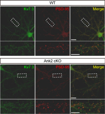 Effects of Ank2 cKO on the localization of Kv7.3 at excitatory and inhibitory synapses in cultured mouse cortical neurons (DIV 17). Note that the colocalization, determined by colocalized areas, between Kv7.3 (green) and PSD-95 (cat. 75-028, 1:1000; red) (an excitatory synapse marker) is not changed, whereas the mean intensity of Kv7.3 at the colocalized area is moderately decreased. Image from publication CC-BY-4.0. PMID:37321992