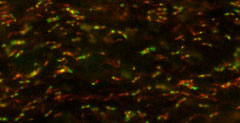 Immunofluorescence staining of nodes of Ranvier in adult rat optic nerve with N106/36 (red) and Caspr rabbit polyclonal (green). Image courtesy of Matt Rasband (Baylor College of Medicine).