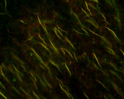 Immunofluorescence staining of axon initial segments in adult rat cortex with N106/36 (red) and bIV- spectrin rabbit polyclonal (green). Image courtesy of Matt Rasband (Baylor College of Medicine).