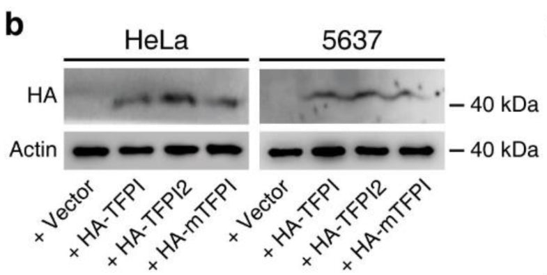 TFPI, TFPI2, and mTFPI were expressed in HeLa or 5637 cells via lentiviral transduction. Expressed exogenous TFPI proteins in cells were confirmed via immunoblot detecting the triple HA tag (cat. ET-HA) fused to their N-termini. Actin (cat. ACT) was used as a loading control. Image from publication CC-BY-4.0. PMID: 36351897