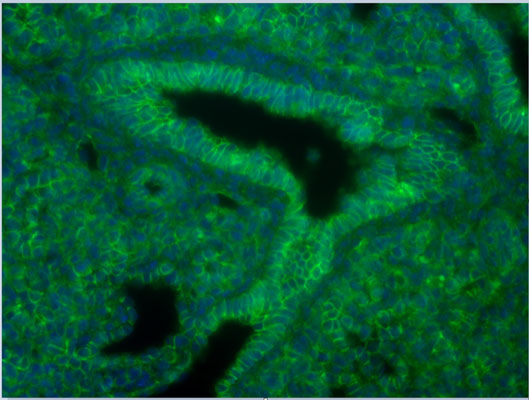 Staining of paraffin wax mouse lung sections using beta-catenin antibody (Cat. No. BCAT, 1:100 dilution) with antigen retrieval and biotinylated secondary antibodies plus streptavidin. Image courtesy of Kuan Zhang (UCSF).
