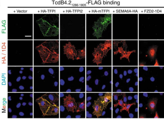 HeLa cells transiently transfected with TFPI, TFPI2, mTFPI, SEMA6A, or FZD2 were exposed to FLAG-tagged TcdB4.21286–1805 (5 µg/mL) on ice for 60 min, washed, fixed, permeabilized, and subjected to immunostaining analysis. Expression of exogenous proteins was confirmed by detecting fused HA (cat. ET-HA) or 1D4 tag. Nuclei were labeled with DAPI (blue)