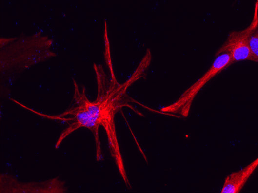 Immunostaining of astrocytes isolated from mouse cortex showing specific detection of GFAP (cat. GFAP, 1:500, red). Nuclei are labeled with DAPI (blue). Image kindly provided by Haofei Ni, Icahn School of Medicine at Mount Sinai.