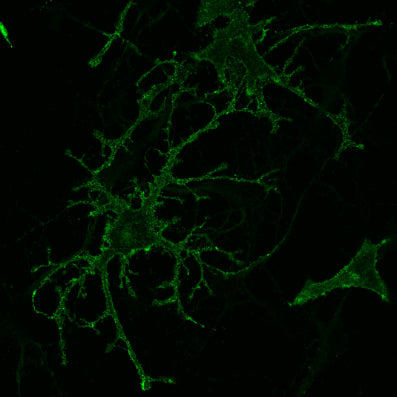 Immunostaining of mouse primary astrocyte cultures expressing a GFP tagged GPCR, stained with GFP (cat. GFP, 1:2500). Image kindly provided by Sandeep Singh, Virginia Commonwealth University.