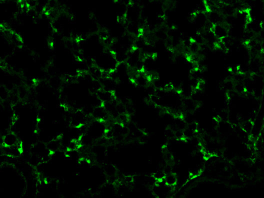 Immunostaining of postnatal day 12 Scube2-CreER ROSA26-tdTomato mouse lung tissues fixed in 4% paraformaldehyde and paraffin embedded (FFPE) showing specific detection of tdTomato in the mesenchyme using mCherry (cat. MCHERRY, 1:100; green). Image kindly provided by Erica Yao, University of California San Francisco).