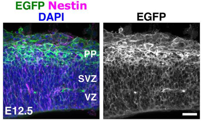 Coronal sections of E12.5 p130Cas::BacEGFP cortices stained for the RGC marker Nestin (cat. NES, 1:500; magenta) and EGFP (green). Counterstain is DAPI (blue). Image from publication CC-BY-4.0. PMID:37540708
