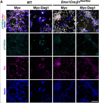 Immunofluorescence for pY165Cas (cyan), c-Myc (magenta), and Nestin (cat. NES, 1:500; blue) of WT and Emx1Cre;β1-Integrinflox/flox mixed cortical cultures transfected with a control vector (myc) or a construct overexpressing myc-tagged full-length Dag1 (myc-Dag1). Counterstain is DAPI (yellow). Image from publication CC-BY-4.0. PMID:37540708
