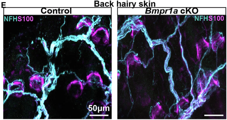 Example images of back hairy skin wholemount staining of NFH (cat. NFH, 1:500) and S100B in control and mutant mice. Overall innervation and lanceolate ending morphologyImage from publication CC-BY-4.0. PMID:37607547