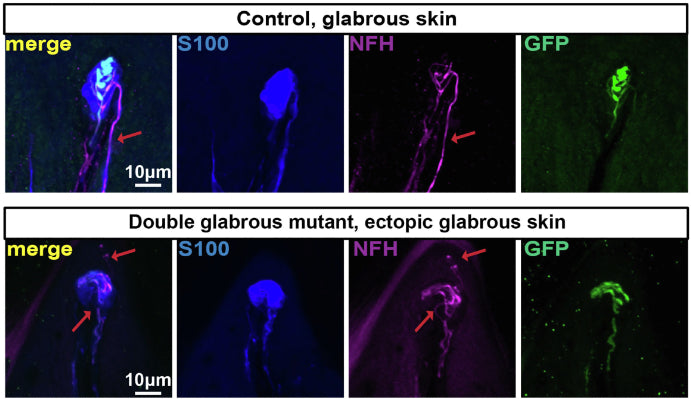 Forelimb pedal pad sections of control Npy2r-GFP glabrous skin (top) and Prx1Cre; Lmx1bfl/fl; Npy2r-GFP double glabrous mutant, ectopic glabrous skin (bottom). The sections are stained using S100, GFP, and NFH (cat. NFH, 1:500). Red arrows point to the GFP- axon (presumably Ret+).Image from publication CC-BY-4.0. PMID:37607547