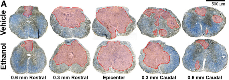 Representative images of mouse spinal cord throughout the rostral-caudal extent of injury 42 days after spinal cord injury (SCI). Sections are stained for myelin (blue, erichrome cyanine) and axons (brown, neurofilament, cat. NFH, 1:1500). Frank lesion areas are highlighted in red. Spared tissue is evident by both blue and brown staining. Image from publication CC-BY-4.0. PMID:37350129
