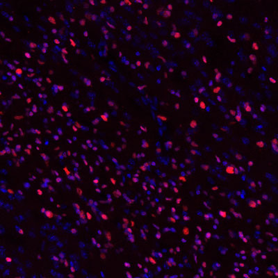 Immunostaining of Olig 2 in 3-month-old mouse brain Olig 2: Red; Nuclear: Blue. Image courtesy of  Mengmeng Jin, Rutgers University.