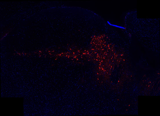 Immunostaining of adult mouse brain section fixed in 4% paraformaldehyde and preserved in cryoprotectant showing specific detection of tyrosine hydroxylase (cat. LNC1-P, 1:500; red) in dopaminergic neurons of the substantia nigra. Nuclei stained with DAPI (blue). Background stain was attenuated with TrueVIEW. Image kindly provided by Ifeoluwa (Hiphy) Awogbindin of the Tremblay Lab, Division of Medical Sciences, University of Victoria, Canada.