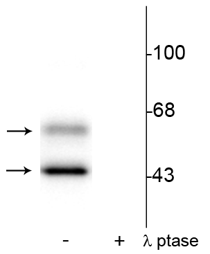 Western blot of rat brain lysate showing specific immunolabeling of the ~50 kDa α- and the ~60 kDa β-CaM Kinase II phosphorylated at Thr286 in the first lane (-). Phosphospecificity is shown in the second lane (+) where the immunolabeling is completely eliminated by blot treatment with lambda phosphatase (λ-Ptase, 1200 units for 30 minutes). 