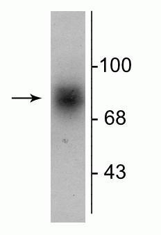 Western blot of human striatal lysate showing specific immunolabeling of the ~88 kDa DAT protein.