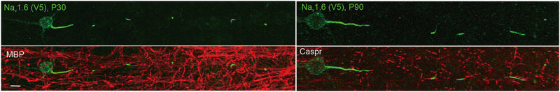Immunostaining of Nav1.6 knock-in neurons (V5, green) in mouse cortex costained with Caspr (red). Image from publication CC-BY-4.0. PMID: 35672149