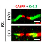Immunofluorescence showing labeling of CASPR (red) and Kv1.2(green) in the spinal cord of P21 Shank3(+ / +) and Shank3Δ11(−/−) mice. Image from publication CC-BY-4.0. PMID: 35726031