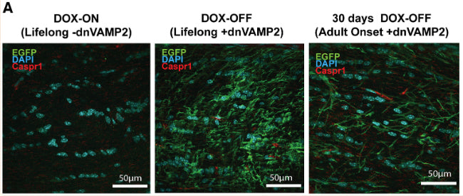 EGFP expression (green) was absent in the optic nerves of [gfap] dnVAMP2 mice supplied DOX (DOX-ON) and prevalent in astrocytes in the optic nerves of [gfap] dnVAMP2 mice on a diet without DOX (DOX-OFF) from gestation through adulthood (P70). EGFP expression in astrocytes was also elevated for a DOX-ON diet through development with DOX_OFF for P40 to P70 (30 d DOX-OFF). The paranodal region labeled with Caspr1 (red). DNA labelled with DAPI (blue). Image from publication CC-BY-4.0. PMID:36302632