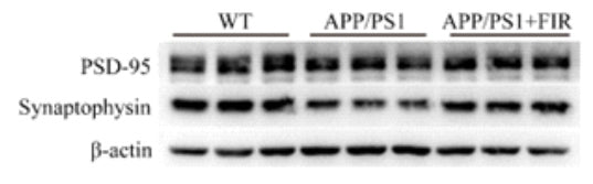 Western blot analysis of PSD-95 and synaptophysin protein in the hippocampus region of AD mice. Image from publication CC-BY-4.0. PMID: 35701825
