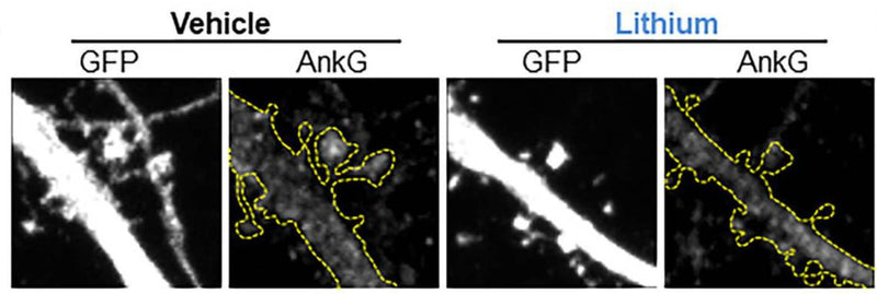 Representative maximal projection of a confocal image of endogenous AnkG (cat. 75-146) staining in rat cortical neurons transfected with GFP with or without lithium stimulation. Image from publication CC-BY-4.0. PMID:36969554