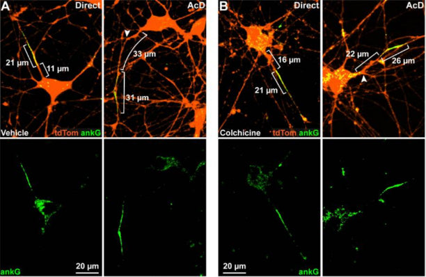 Example images of ankG labeling (cat. 75-146, 1:200; green) in hRGCs (orange) treated with vehicle (A) or colchicine (B). Image from publication CC-BY-4.0. PMID:37010860