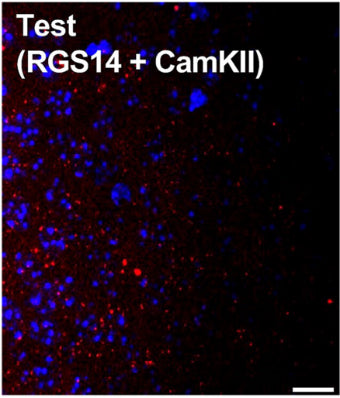 Coronal section from a C57BL/6J mouse CA2 hippocampus showing duolink staining where signal (red) denotes interaction between two proteins targeted with primary antibodies RGS14 (cat. 75-170, 1:500) and CaMKII to test for protein interaction. Image from publication CC-BY-4.0. PMID:36971428