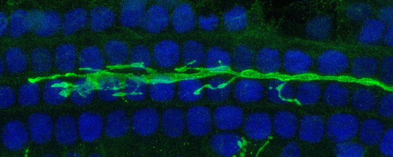 Mouse auditory neurons expressing a V5-tagged reporter protein were stained with Aves Labs chicken anti-V5 antibody at 1:500. Photo courtesy of Thomas Coate.