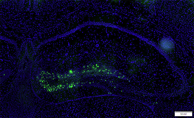 Immunostaining of mouse hippocampus identifying injected HSV containing GFP (Cat GFP, 1:250, green) and DAPI (blue). Image kindly provided by Chad Brunswick, Penn State University. 