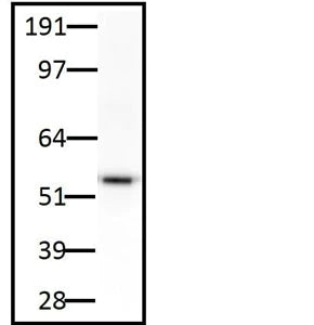 LNC1 anti-TH monoclonal antibody was used at 2.5 ug/mL to stain endogenous tyrosine hydroxylase in rat brain lysate.
