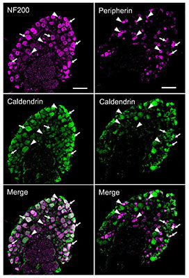 Confocal micrographs of DRG cryosections from WT mouse double-labeled with antibodies against caldendrin (green) and NF200 (Cat no. NFH, 1:1000, purple) or peripherin (Cat no. PER, 1:1000, purple). Arrows and arrowheads indicate cells in which caldendrin is or is not, respectively, co-localized with NF200 or peripherin. Results are representative of at least 3 independent experiments. Scale bar, 100 µm.  Image from publication CC-BY-4.0. PMID:36788334