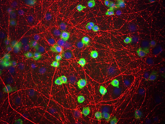 Co-staining of Coronin1 (COR, green, 1:1000 dilution) and Internexin (rabbit antibody, red, 1:500) in a culture of mouse cerebral cortical tissue fixed with 4% paraformaldehyde. Photo by Dr. Gerry Shaw, Univ. Florida.