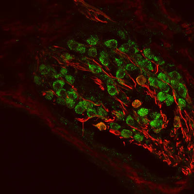 Doublecortin (1:1000 dilution, green) staining of a tissue section (4% paraformaldehyde-fixed, paraffin- embedded) through the cochlear ganglion from a neonatal mouse. Red staining is neurofilament, NF-M, visualized with Texas Red-goat anti-rabbit IgG.