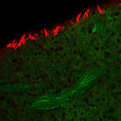 Doublecortin (1:1000 dilution, red) staining of a tissue section (4% paraformaldehyde-fixed, paraffin-embedded) through the cerebral cortical periventricular zone cerebellar cortex of a neonatal mouse. Green staining is neurofilament, NF-M, visualized with fluorescein-goat anti-rabbit IgG.