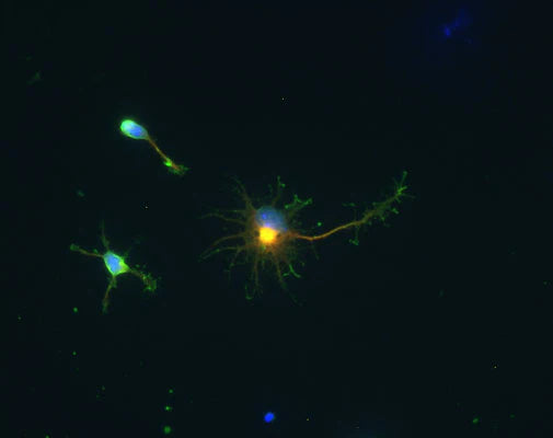 Immunocytochemical staining of GAD-67 (red/yellow) in cultured cortical neurons from a neonatal mouse (C57/Black6). GAD staining was detected using Texas Red goat anti-chicken IgY (1:500). MAP2 staining (green) used a rabbit antibody (1:500). Hoda Ilias, Aves Labs.