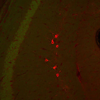 Immunohistochemical staining of inhibitory neurons (red; 1:500) within the hippocampal formation of a transgenic, adult male Black6 mouse brain. The brains were fixed with 4.0% paraformaldehyde. The green staining is low level GFP fluorescence expressed off the actin promoter in this mouse transgenic strain. Secondary antibody (Texas Red goat anti-chicken IgY, (1:500).