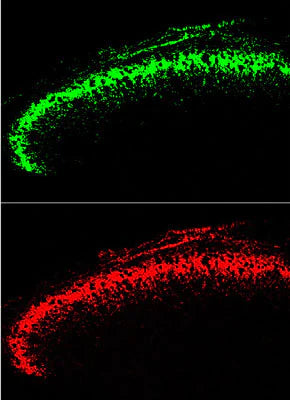 Transgenic Mice Expressing Green Fluorescent Protein under the